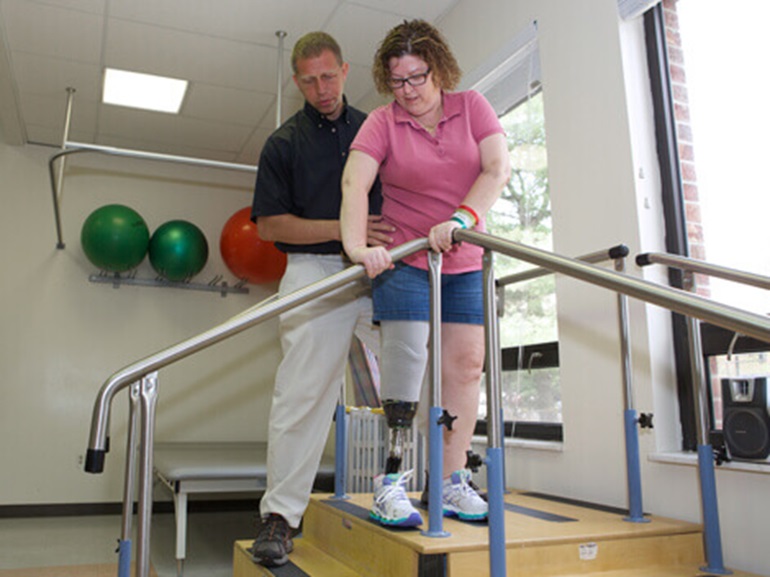 Female patient with prosthetic leg climbs steps in therapy session.